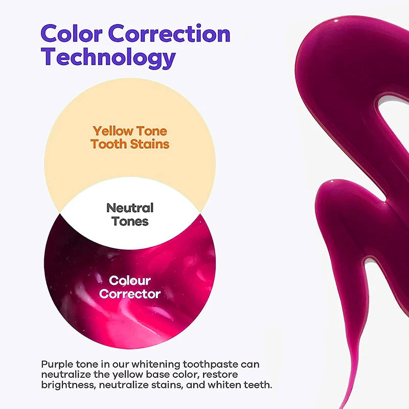 VioletSmile® By Whiten