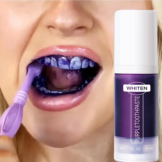 VioletSmile® By Whiten
